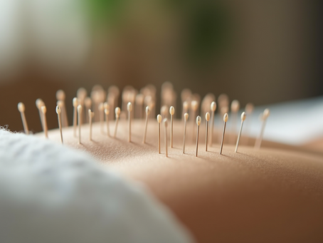 Essential Guide to Acupuncture Services for Well-being