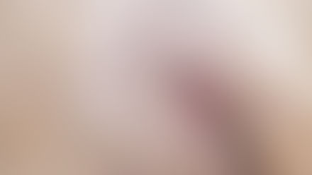 Animal resgatado pela ONG OS SALVADORES, passa por cirurgia. Instituição busca recursos.