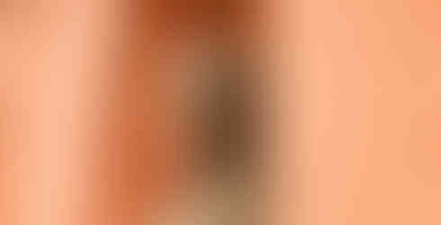 Memento Park (Szoborpark)