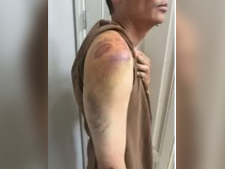 南加警毆打華裔聯邦幹員 飆罵「中國來的X」 挨告