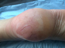 13566987_143395079416089_4305537206998340419_n