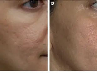 PHOTOGRAPHY IN FACIAL ESTHETICS