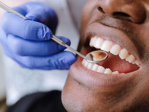 How Often Should You Really See the Dentist?