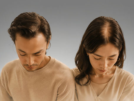 male and female with androgenetic alopecia
