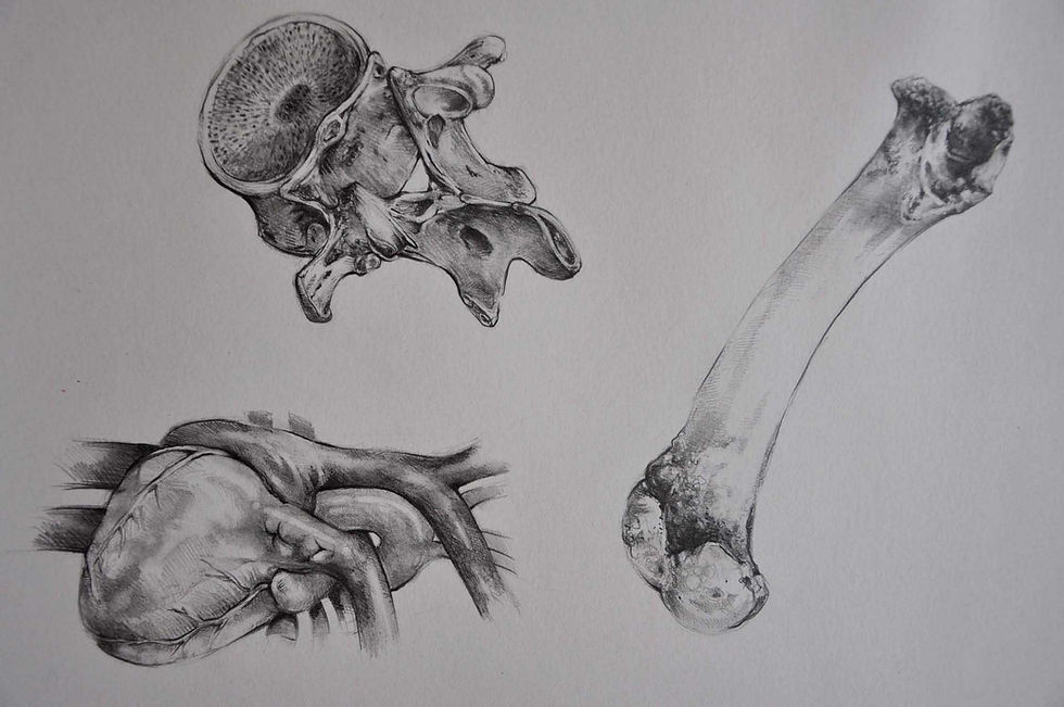 study