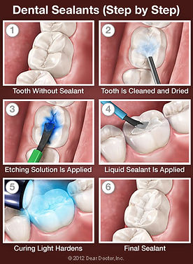 sealants-step-by-step-thumb (1).jpg