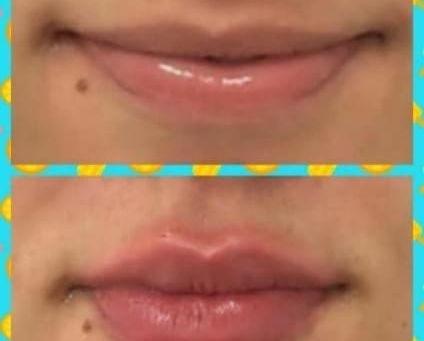 Sabe como funciona a micropigmentação labial