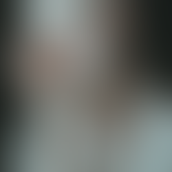 Living with Hypermobile Ehlers-Danlos Syndrome (EDS): Challenges, Management, and Hope