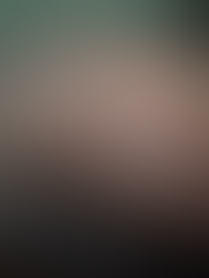 Understanding the Causes of Male Hair Loss: What Every Man Should Know