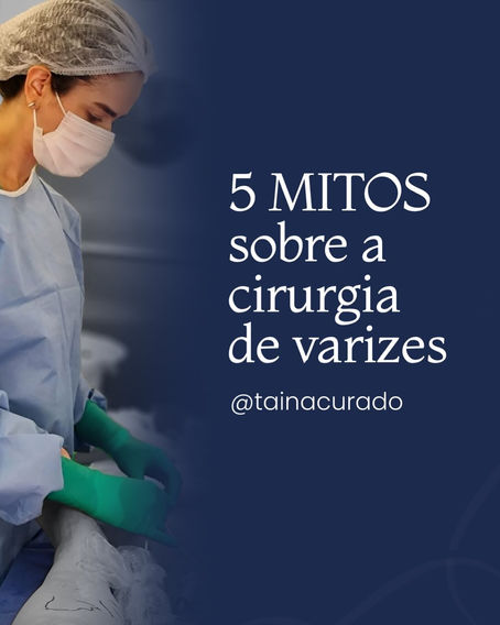 5 mitos sobre a cirurgia de varizes