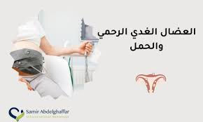 العضال الغدي الرحمي والحمل