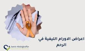 متى يكون حجم الورم الليفي خطير