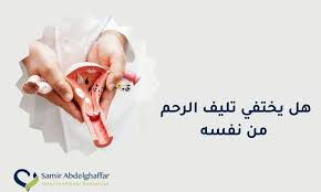 هل يختفي تليف الرحم من نفسه