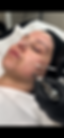 PRP vampire facial trowbridge