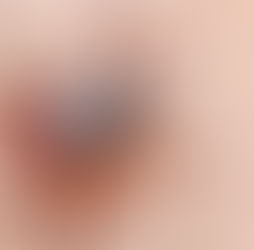 riscos dos carrapatos