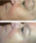 resultaat deep skin.png