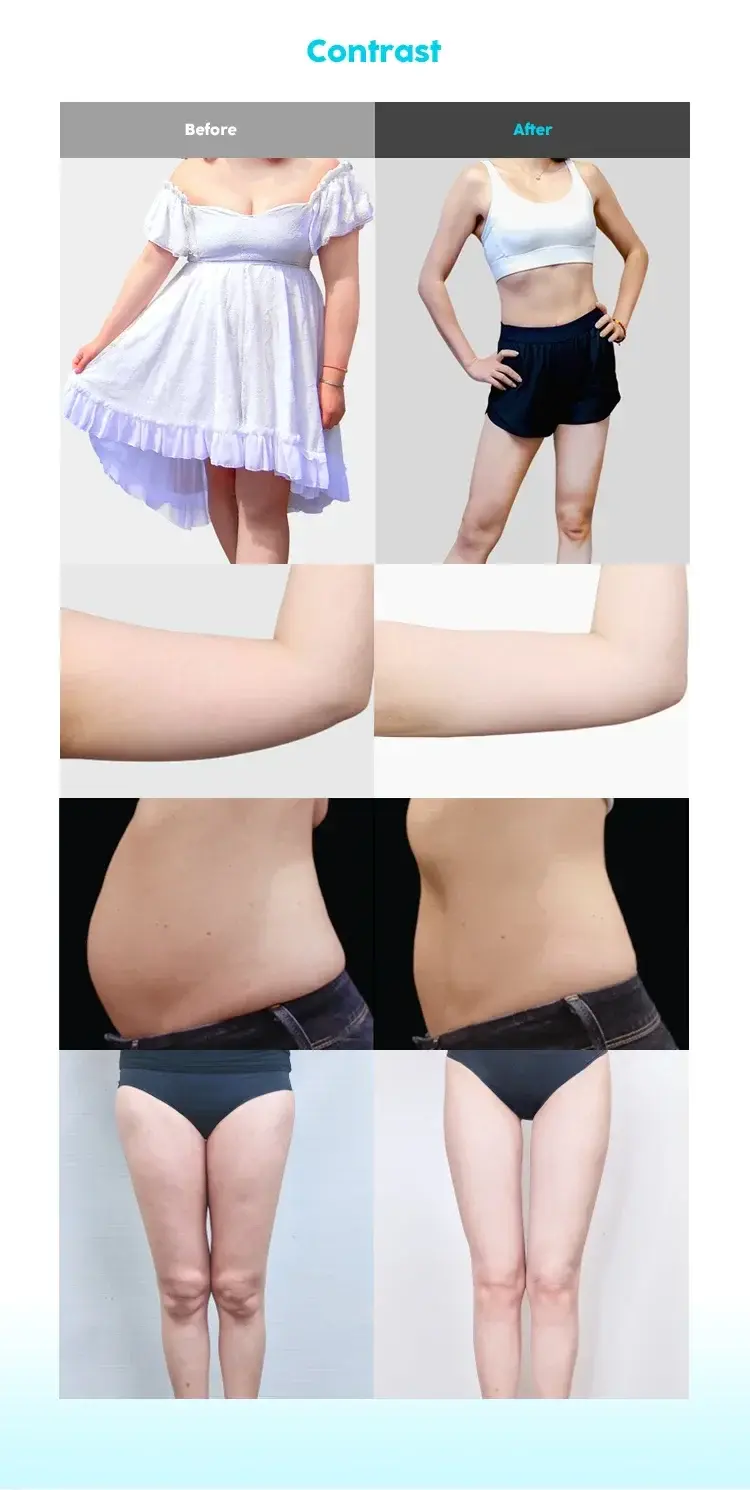 Miniaturbild: K6 Venus Legacy Handle Ultrasonic Cavitation Machine Radio Frequency