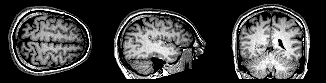BrainMRI3planes.gif