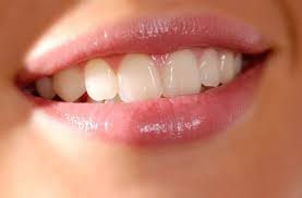 Thực sự bọc răng sứ có an toàn không?