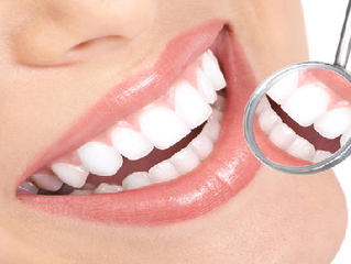 So sánh răng sứ thường và răng sứ titan, nên chọn loại nào?