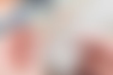 Ưu điểm nổi trội của giải pháp bọc răng sứ veneer?