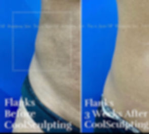 FullSizeRender-1.jpeg