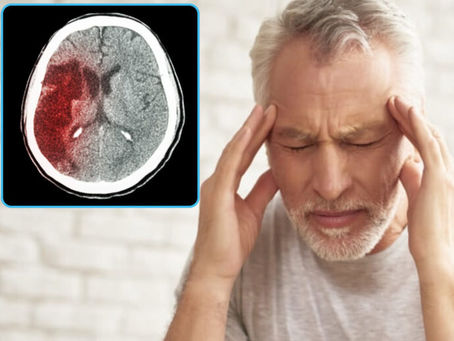 Інсульт: Що це за хвороба, як її лікують в Ужгороді та чи можливо уберегтися? (ВІДЕО)