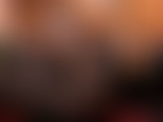 Професор Володимир Смоланка навчав європейських нейрохірургів у рамках курсів EANS