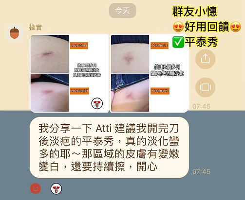 Pentaxyl 平泰秀使用回饋 3.jpg