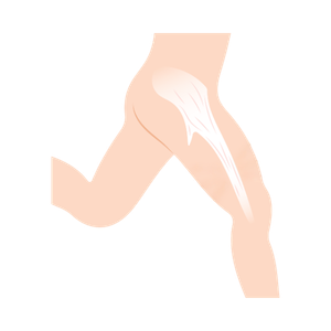 fascia lata