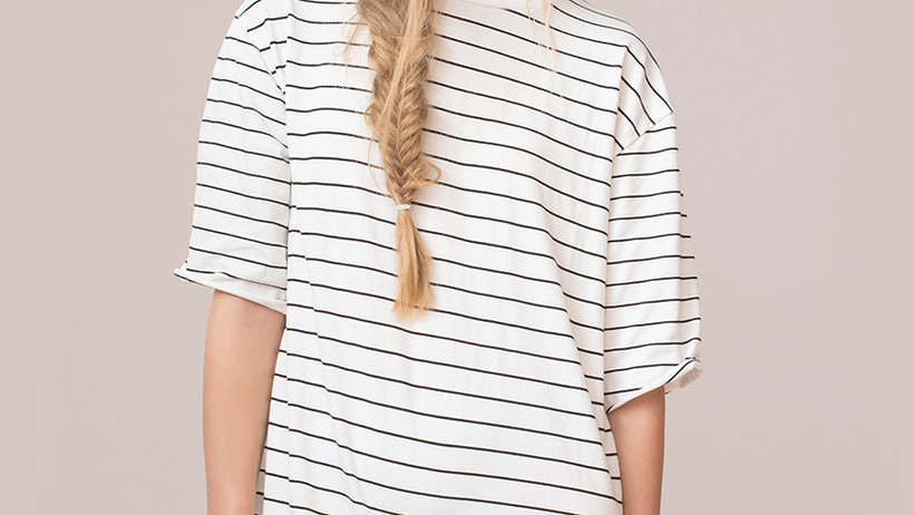 Model in Striped Dress