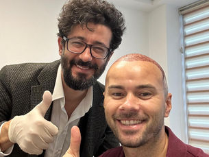 Things to Know Before Hair Transplant