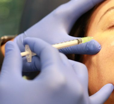 botox application