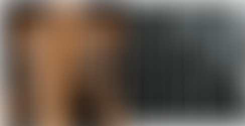 The Stoneman Syndrome 