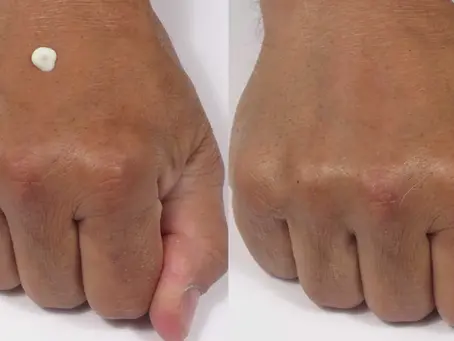 There Is No Reason to Not Use a Mineral Sunscreen