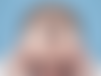 How Much Does a Hair Transplant Cost? What Affects the Price?