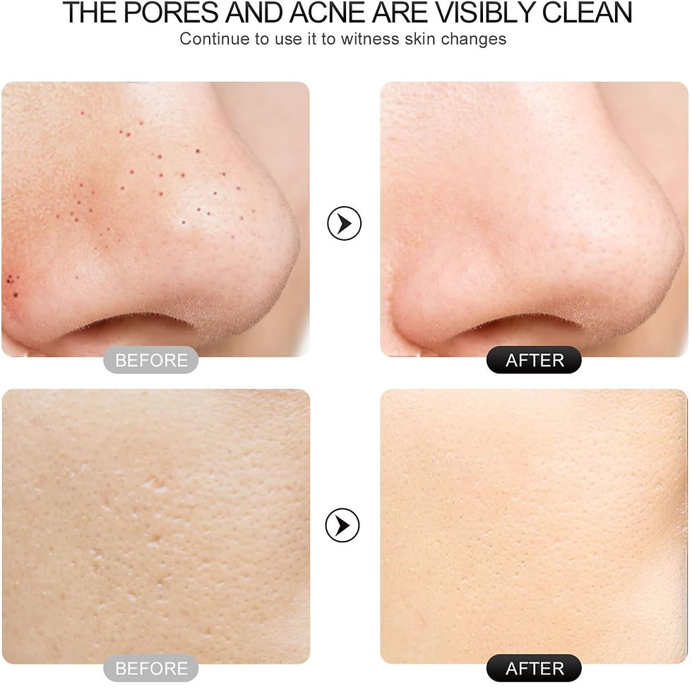 Miniatura: Purificador Facial Ultrassônico