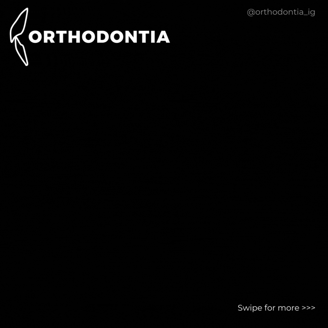 Orthodontic Blog about our teaching Orthodontia