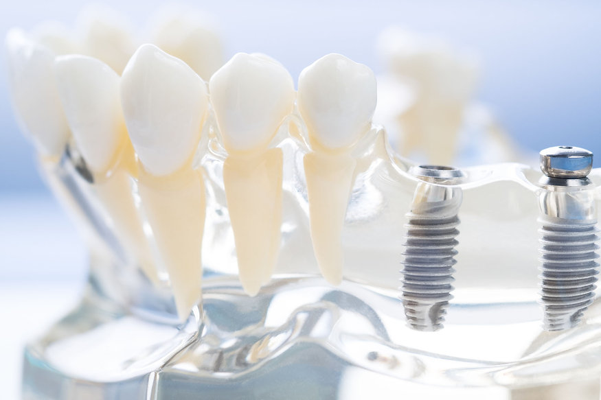 AdobeStock_221521089.jpeg