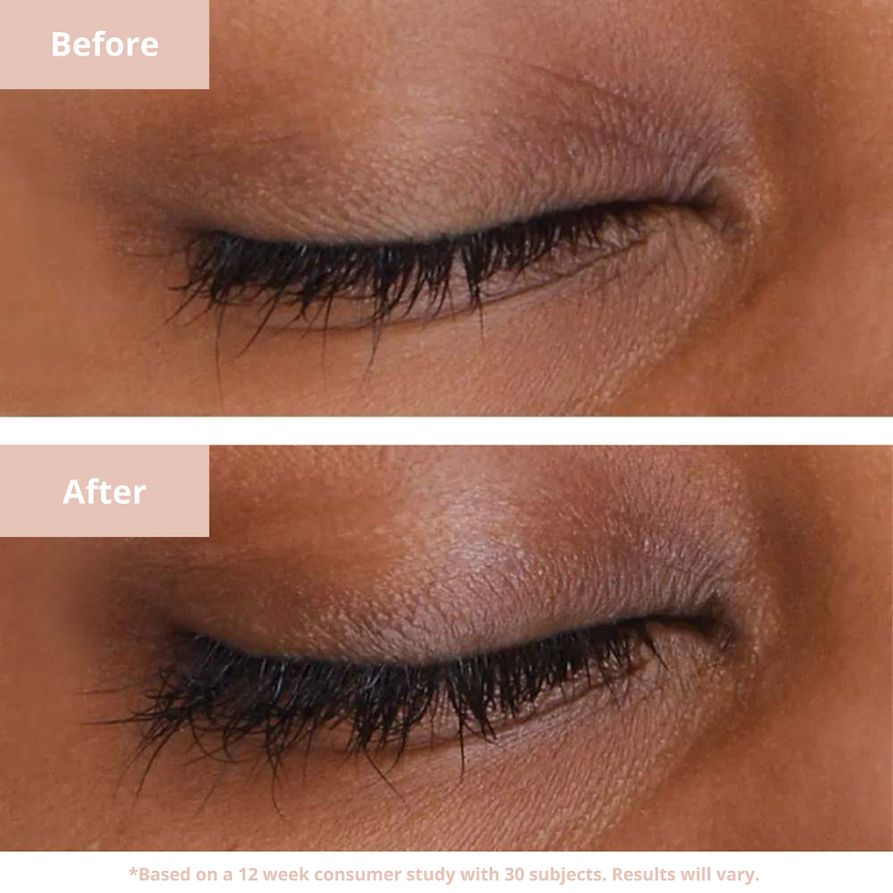 Miniatura: GROLASHES Eyelash Serum