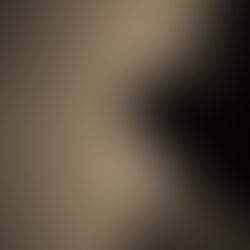 Different Spectrum of the Dark (Part I)