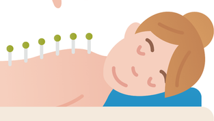 Acupuncture