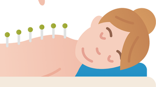 Acupuncture