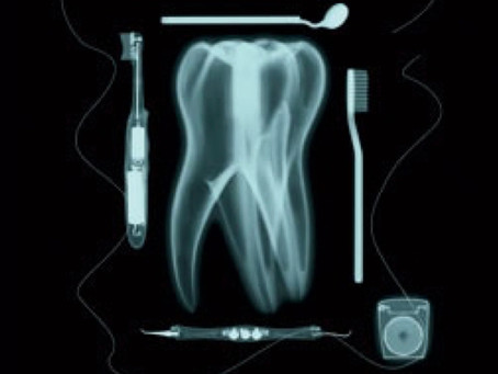 Why do we need Dental X-rays?