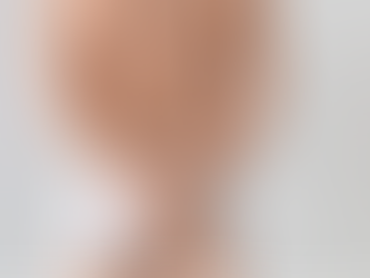 Procedimentos de harmonização íntima masculina com ácido hialurônico e bioestimuladores para proporção e rejuvenescimento