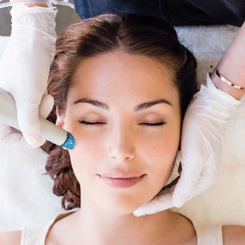 rosacea-Hydrafacial-4