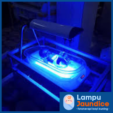 rawatan baby kuning lampu jaundice penyakit kuning deman kuning bayi
