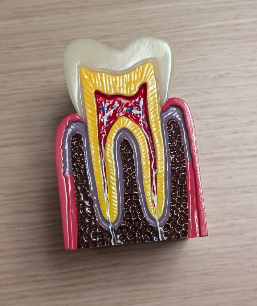 Miniature : Modèle dentaire 2 faces