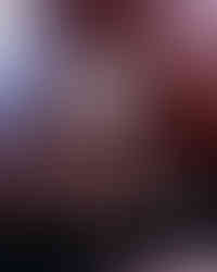 Kiss Facility at KOKO