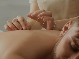 Acupuncture guelph_edited.jpg